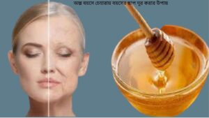 অল্প বয়সে চেহারায় বয়সের ছাপ দূর করার উপায়